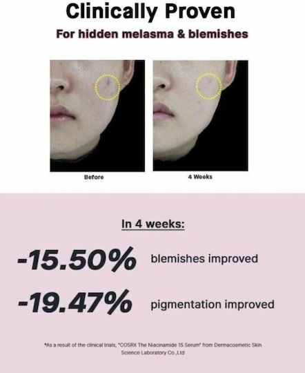 Cosrx The Niacinamide 15 Serum Προσώπου με Νιασιναμίδη για Λάμψη & Ακμή 20ml