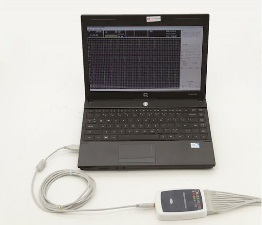 Contec8000g Wireless Cardiograph 12 Channels