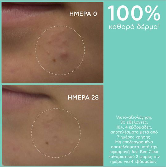 Apivita Just Bee Clear Gel Față pentru Ten Acneic 200ml