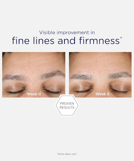 Neostrata Skin Active Hyaluronic Luminous Lift Κρέμα Προσώπου για Ενυδάτωση, Αντιγήρανση & Σύσφιξη με Ρετινόλη & Υαλουρονικό Οξύ 50gr
