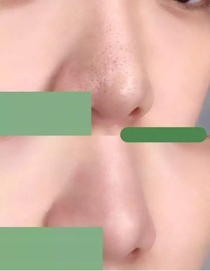 Meidian Green Mask Stick Face Mask