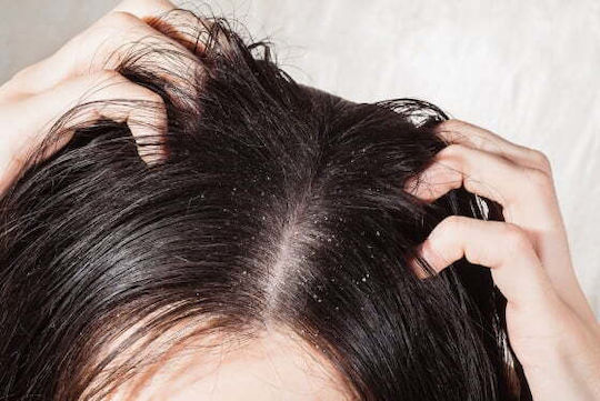 Шампоан против пърхот за суха коса Lakme K.therapy Peeling Dry Shampoo 1000ml
