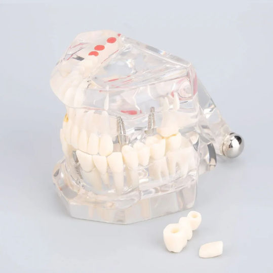 Dental Demonstration Model Ubx Mobilizable Teeth Implants Restorations Dental Pathologi