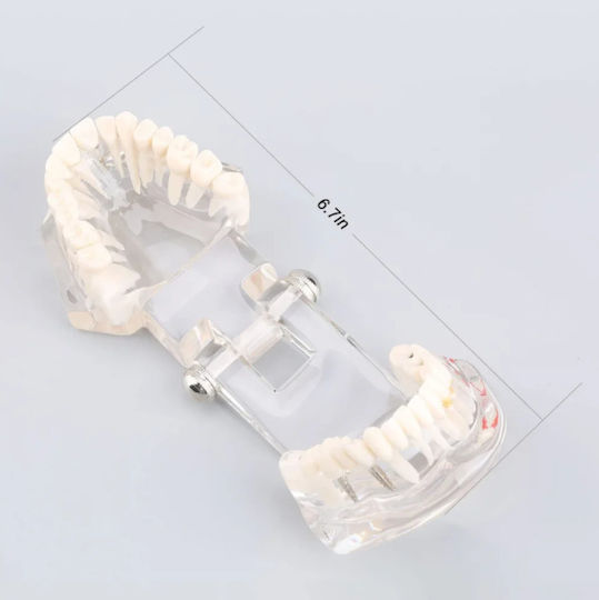 Dental Demonstration Model Ubx Mobilizable Teeth Implants Restorations Dental Pathologi