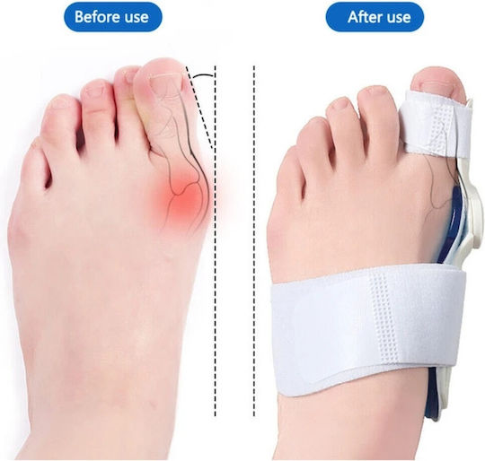 IP Insoles Bunion Splint IP018