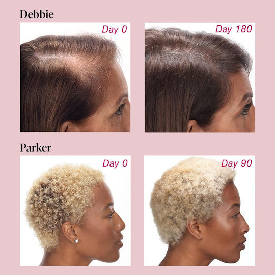 Hair Growth 60 Ταμπλέτες