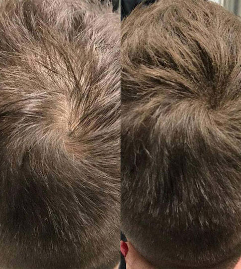 Beaver Fibre Acoperirea Subțierii Părului cu keratină 12gr