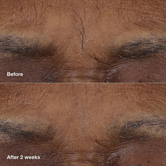 Clinique Smart Clinical Repair Balm Ματιών για Ενυδάτωση 3gr