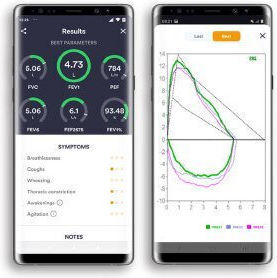 MIR Spirometer Spirobank Smart