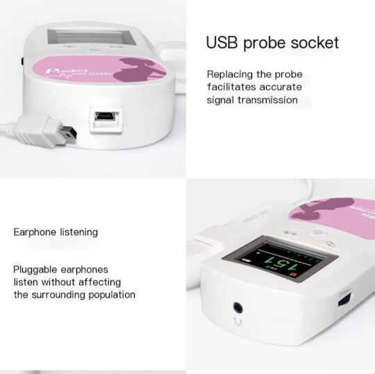 Contec Baby Sound C1 Gynecological Doppler