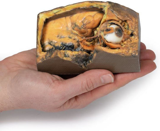 Erler Zimmer Internal Organs Model