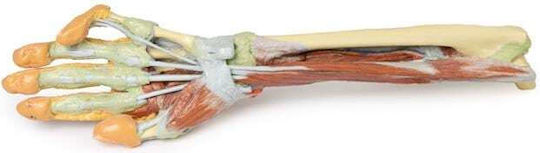 Erler Zimmer Πρόπλασμα Άκρων & Αρθρώσεων