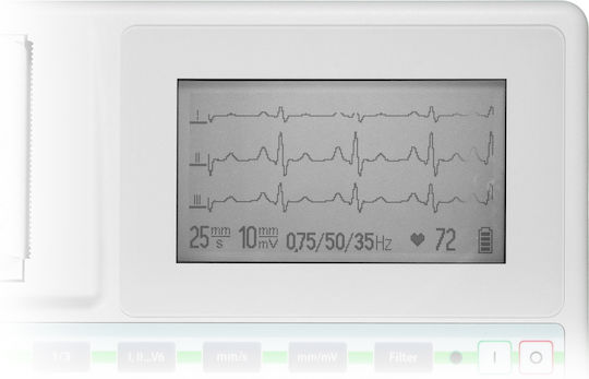 Aspel Green v.05.101 Cardiographer 3-Channel