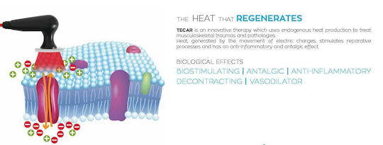 I-Tech Tecar CR 200 Physiotherapy Device
