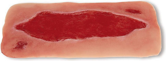 Large Arterial Ulcer Leg Wound Granulation Phase Erler Zimmer