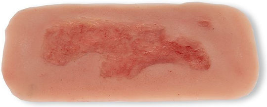 Small Arterial Ulcer Foot Wound Epithelium Phase Erler Zimmer