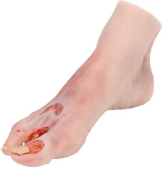 Training Manikin "Diabetic Foot Actinic Resection" Erler Zimmer