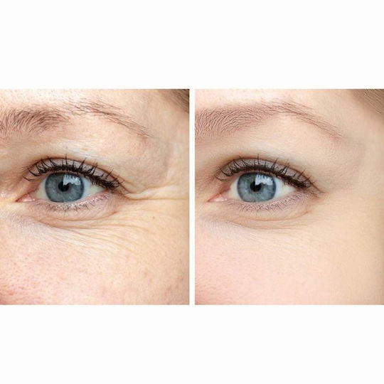 Gesicht-Roller Melume Skinscience 1 Stück