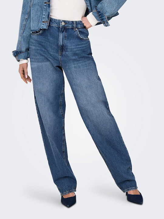 Only Only