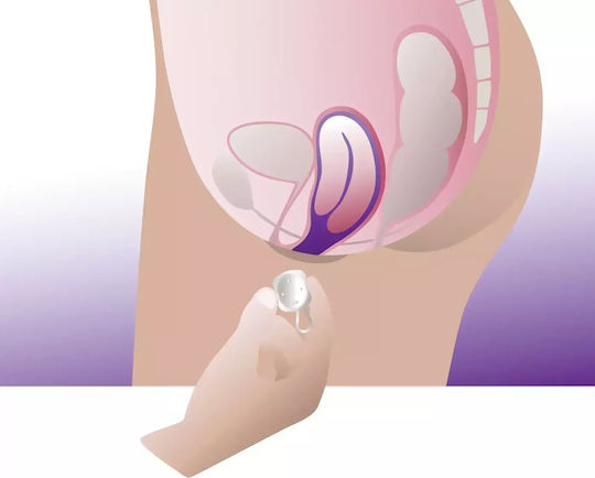 ProFem Vaginal-Pessar Cube Pessary ohne Οπές Ohne Löcher