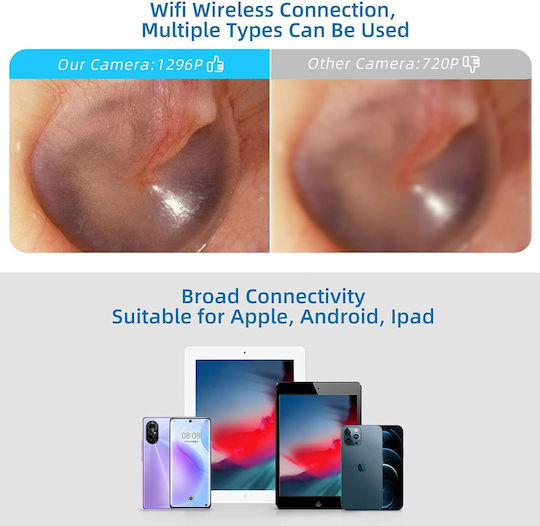 Dispozitiv Otoscop Wifi Îndepărtare Ceară Ureche Cameră 5 Mp Lumini Led Rezistent La Apă Ip67 Vizualizare Live Prin Aplicație Android Ios Negru