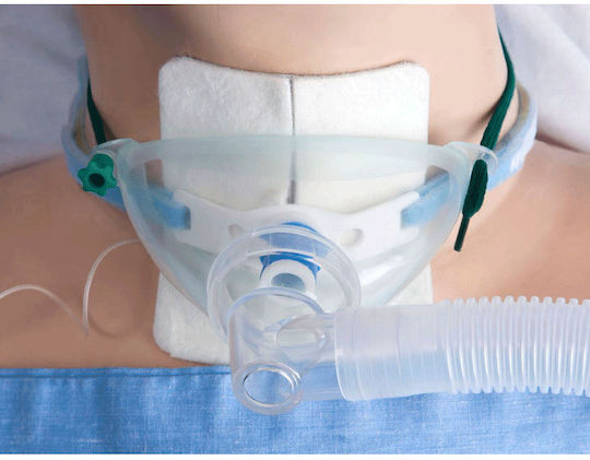 Tracheostomy Oxygen Nebulization Mask Ningbo A0601