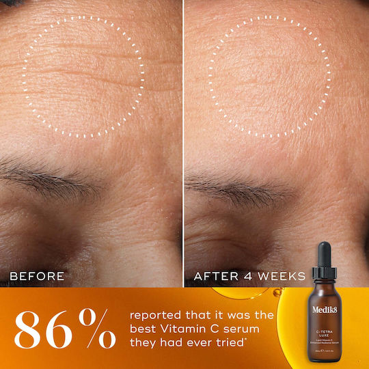 Medik8 C-Tetra Luxe Anti-aging Serum Face with Vitamin C & Vitamin E for Detoxification & Radiance 8ml