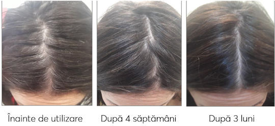 Ageless Clinic Treatment Plus Against Graying Loțiune de Păr împotriva Căderii Părului 210ml