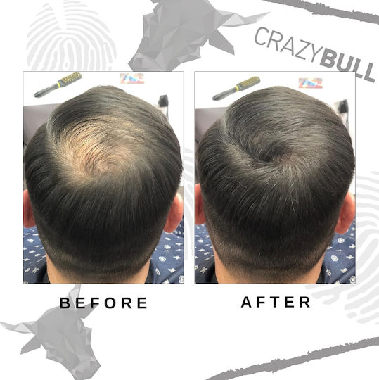 Hair Thinning Coverage Fibers Crazy Bull Hair Building Lightning Fibers Brunette 22g