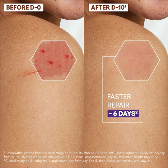 A-Derma Epitheliale A.H. Ultra Repair Ενυδατική Κρέμα Ανάπλασης με Υαλουρονικό Οξύ για Ξηρές & Ευαίσθητες Επιδερμίδες 100ml