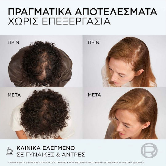 L'Oreal Paris Elvive Growth Booster Conditioner κατά της Τριχόπτωσης 150ml