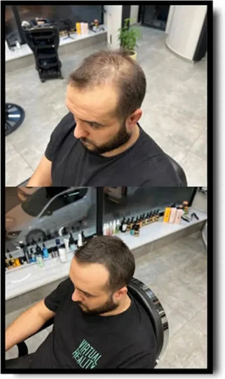 Hair Thinning Coverage Batci Hair Concealer Filling