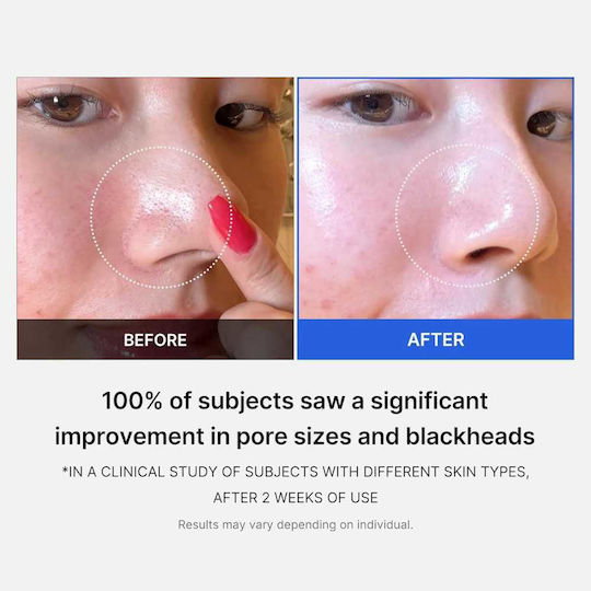 Medicube Zero Pore Pads Facial Toning 70pcs