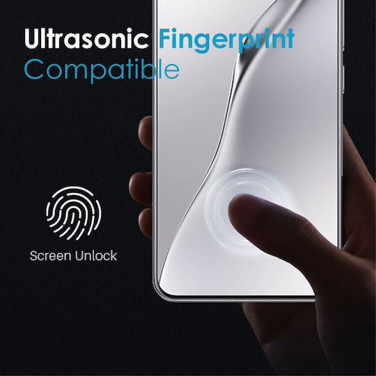 Anti-Spion Privatsphäre Vollkleber Panzerglas Xiaomi 15 5g Schwarz