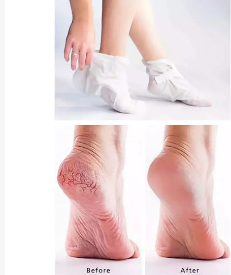 Farm Stay Moisturizing / Νourishing / Peeling Mask for Legs 14gr