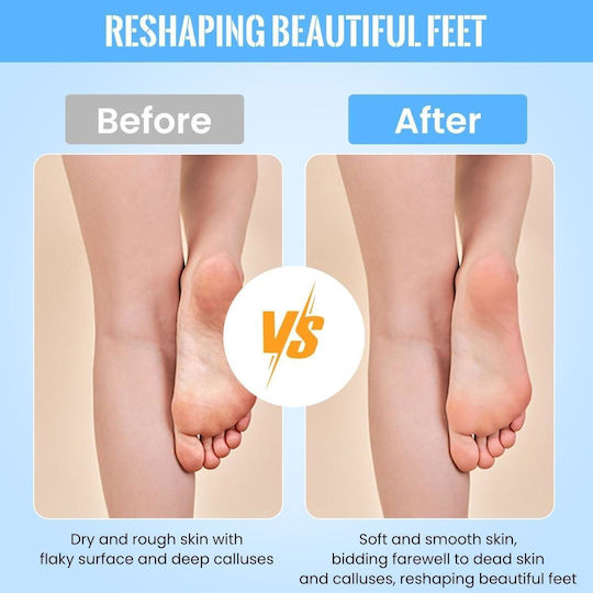 Electric File USB Heels Callus