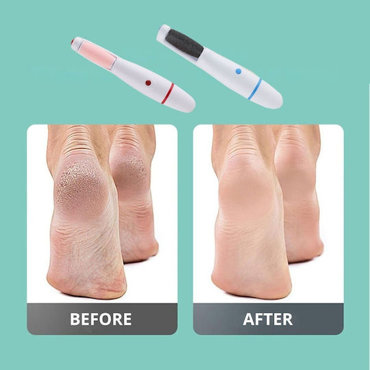Electric Foot File Battery & USB Heels Callus Red