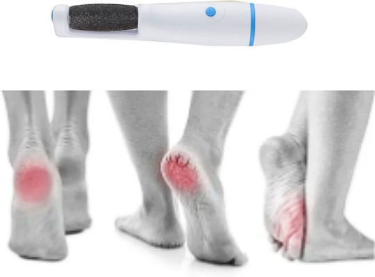 Electric Foot File Battery & USB Heels Callus Blue