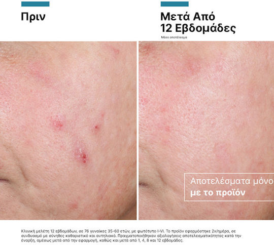 SkinCeuticals Advanced RGN-6 Cream Face Day 50ml