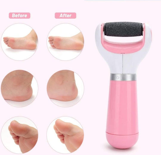 Electric Battery Foot File Heels Callus Pink