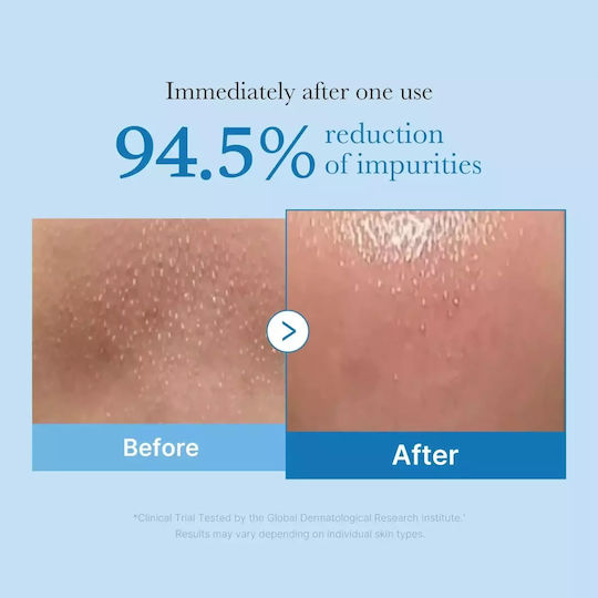 Medicube Zero Pore Blackhead Λάδι Καθαρισμού Προσώπου 205ml