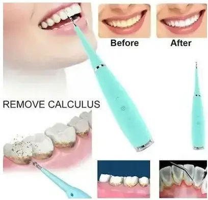 Andowl Dental Scaler Ηλεκτρική Οδοντόβουρτσα Γαλάζιο