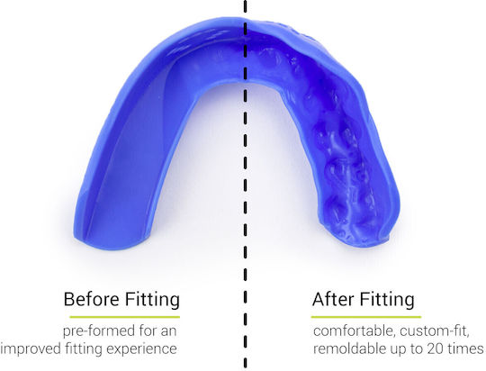 Μασέλα Sisu 3d Custom Fit Royal Blue