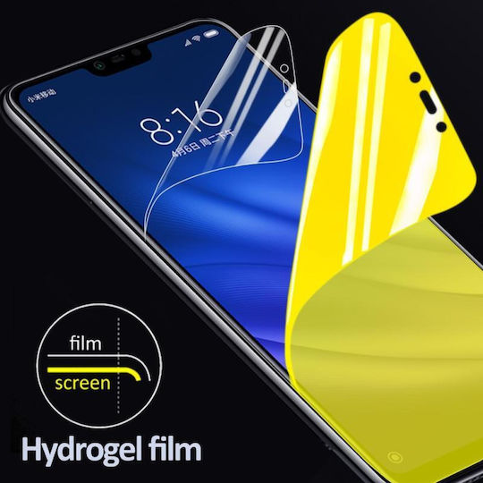 Screen Protector (Huawei P20 Lite)