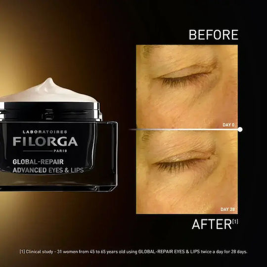 Filorga Global-repair Advanced Cremă Antirid Pentru Conturul Ochilor și Buze 15 Ml