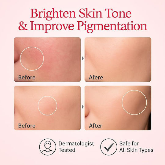 Anua Niacinamide 10%+TXA 4% Ενυδατικό Serum Προσώπου με Νιασιναμίδη & Υαλουρονικό Οξύ για Λάμψη & Πανάδες 30ml