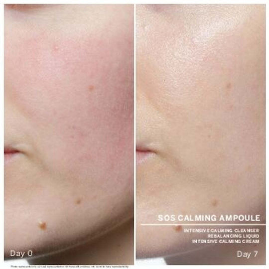 Babor Serum Ampulă Calmare Față 7x2ml