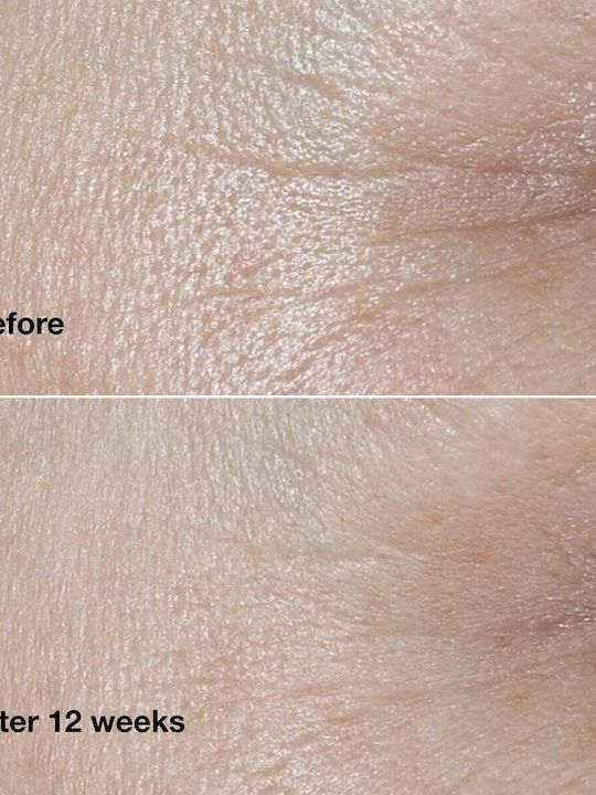 Clinique Wrinkle Fighting Routine Skin Care Set for Anti-ageing