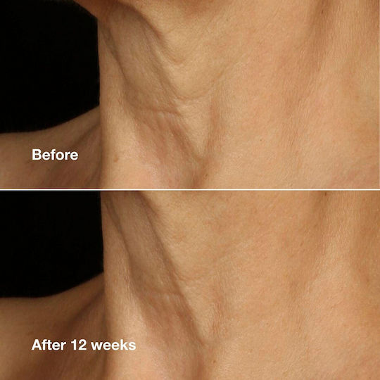 Clinique Lift+Smooth Routine Σετ Περιποίησης για Αντιγήρανση & Σύσφιξη 4τμχ