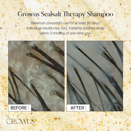Growus Sea Salth Therapy Shampoo for Sensitive Scalp Against Dandruff & Hair Loss for Oily Hair 500ml